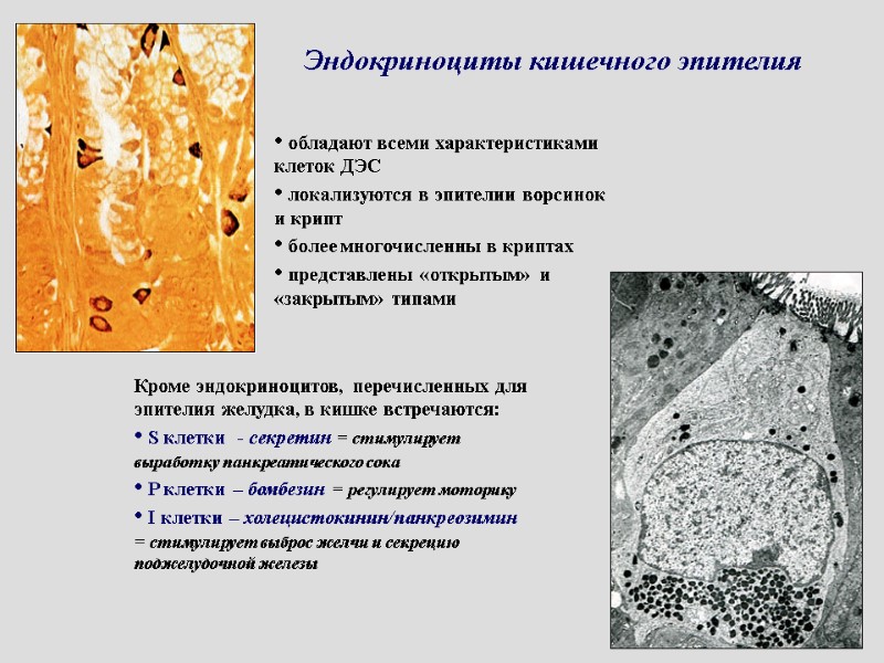 Эндокриноциты кишечного эпителия Кроме эндокриноцитов, перечисленных для эпителия желудка, в кишке встречаются:  S